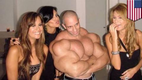 Synthol Freaks Get Fake Muscles The Dumbest Way
