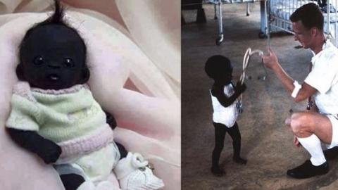 Is This The 'Darkest Baby In The World'?