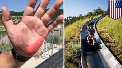 Texas Father And Son Cooked By Hot Metal Slide