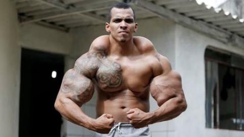 Bodybuilder Risks His Life By Injecting Oil and Alcohol